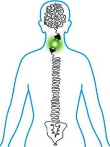 La subluxación vertebral y la quiropráctica