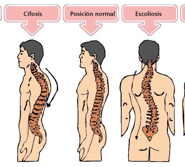 Anatomía de la columna vertebral (I). Curvaturas.