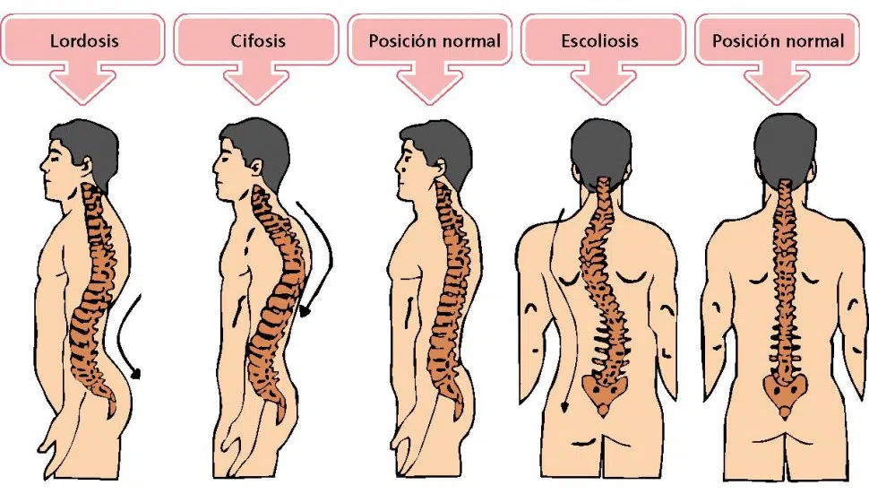 Huesos de la columna vertebral: Vídeo & Anatomía