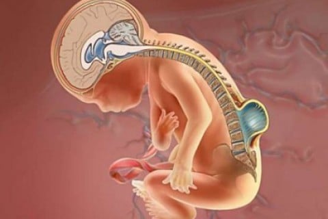 La espina bífida en el bebé
