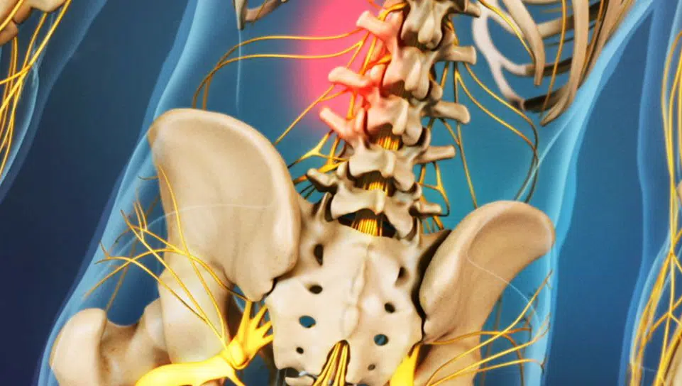 Quiropráctica, una excelente alternativa antiinflamatoria a los tratamientos químicos