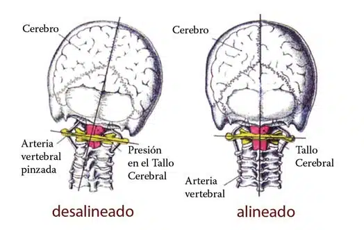 quiropráctica-disminuye-presión-arterial